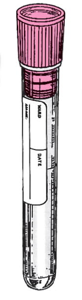 Paquete de 100 Tubos de 0.3ml Citrato de Sodio 3ml 13x75mm Kima